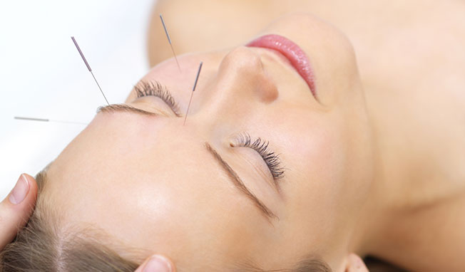 acupuncture to fight anti wrinkles