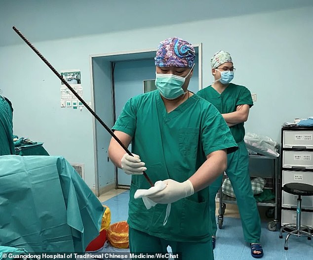After conducting a three-hour emergency surgery, a team of surgeons successfully removed the steel bar from Ms Xiang. A medic is seen holding the 31-inch metal bar after the surgery