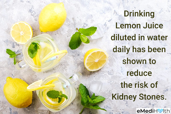lemon prevents kidney stone