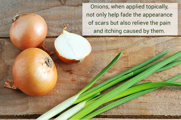 onion helps manage scars