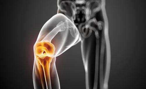Препараты для восстановления связок колена. Уколы для восстановления связок колена